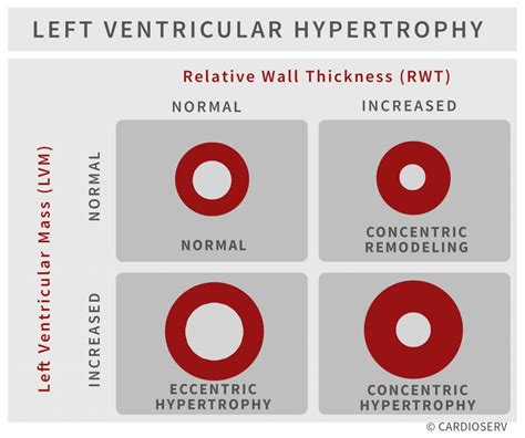 lv hypertrophy echo|left ventricular wall thickness measurement.